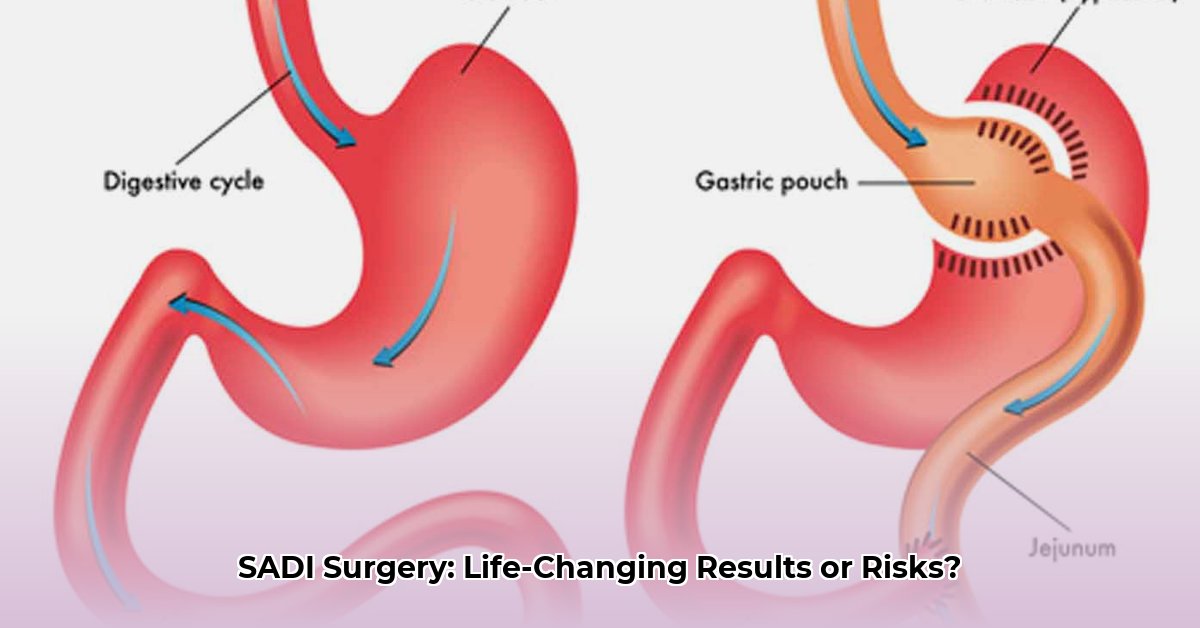 sadi-weight-loss-surgery-reviews